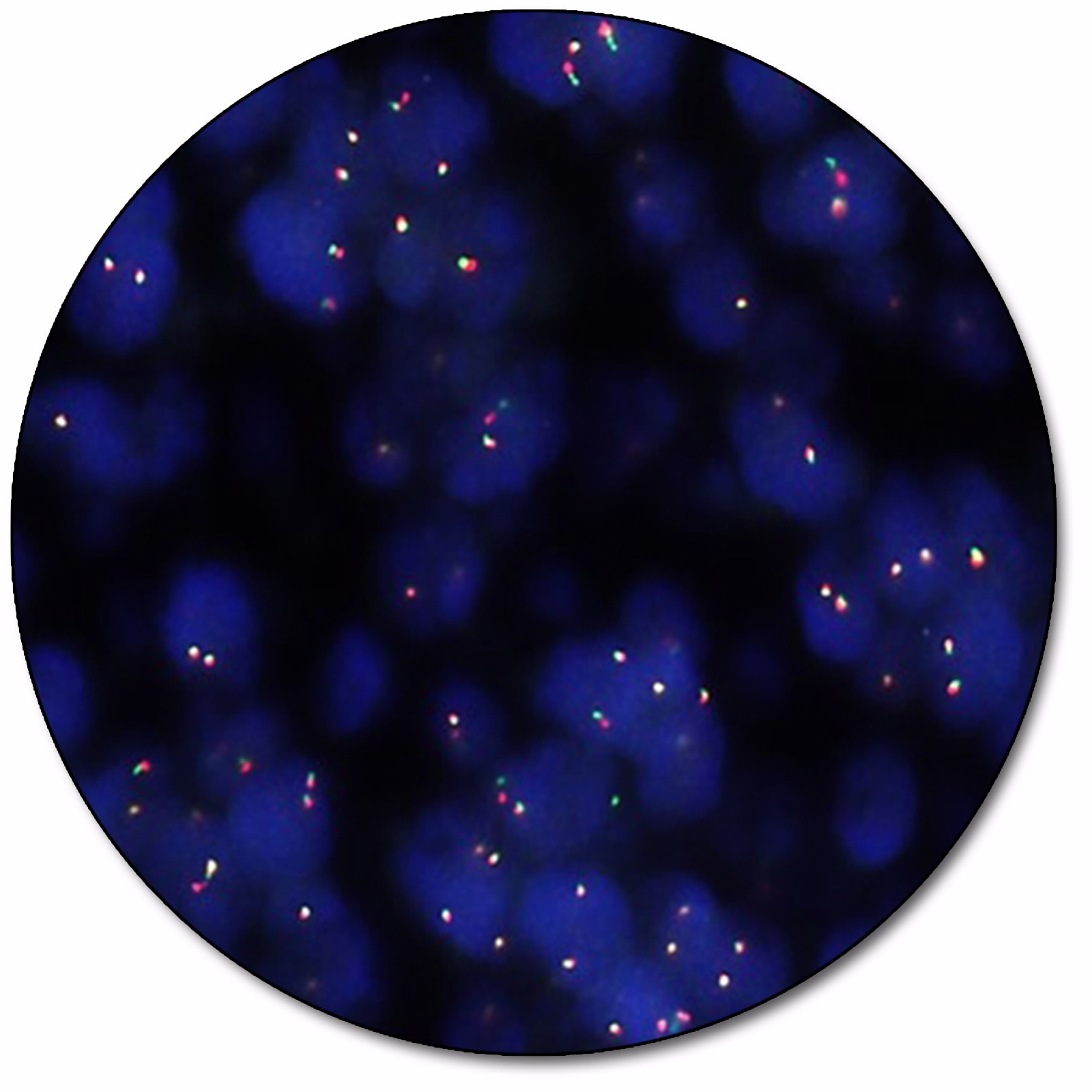 CCND1 IQFISH Break-Apart Probe