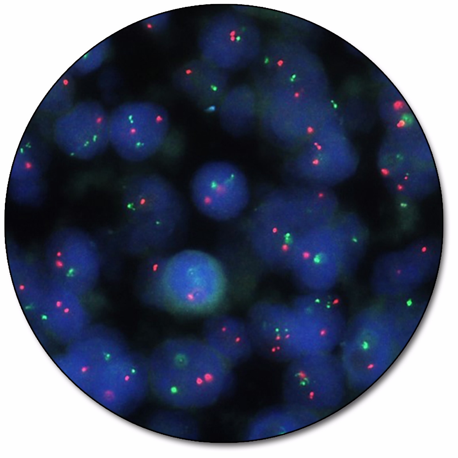 IGH/MYC IQFISH Dual Fusion Probe