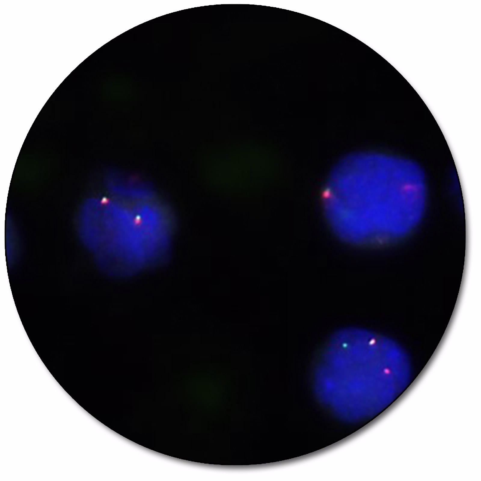 MYC IQFISH Break-Apart Probe