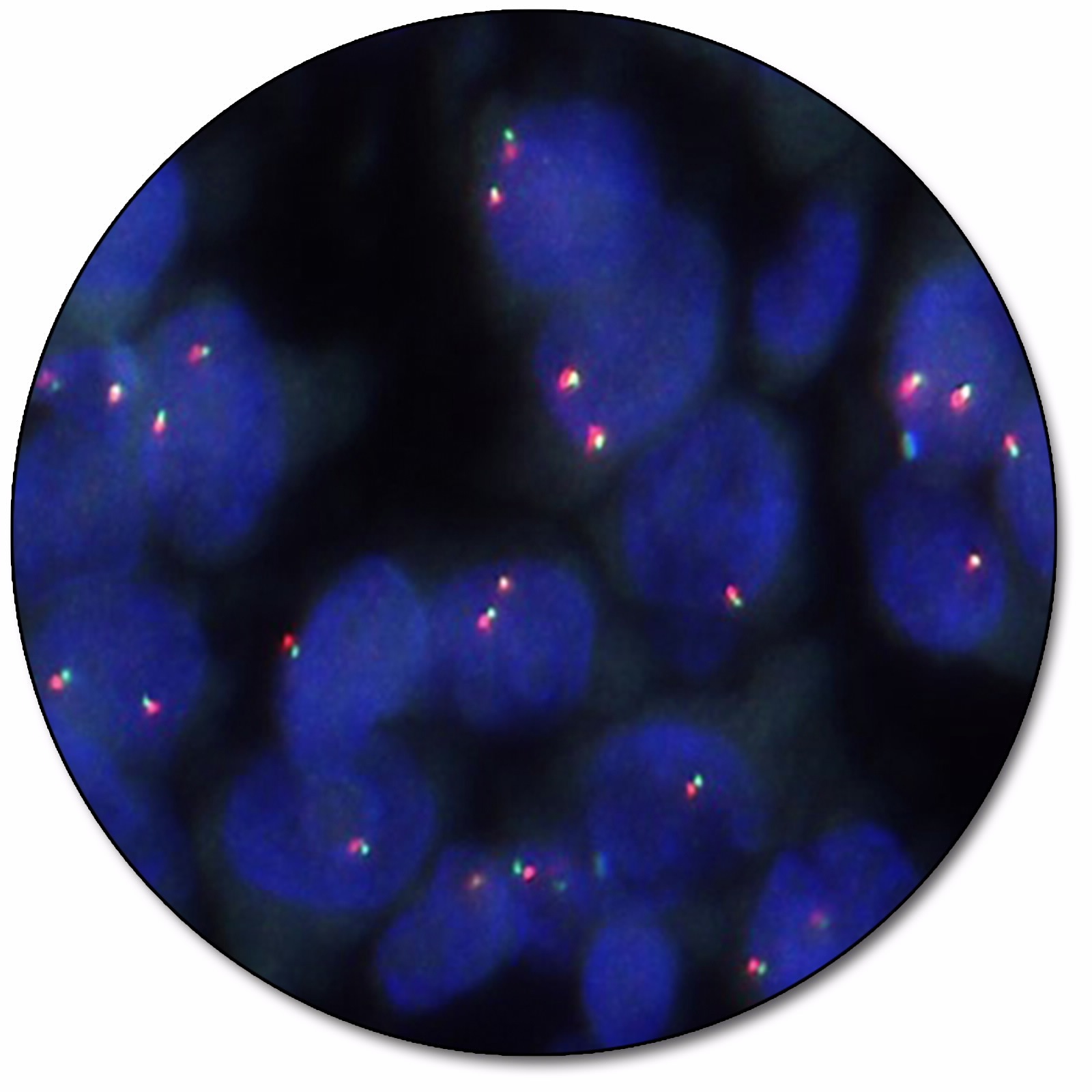 MYC IQFISH Break-Apart Probe