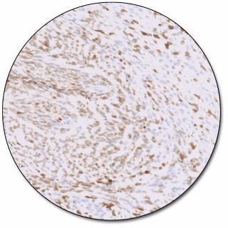 MAGE-A4 IHC 1F9 pharmDx 
