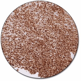 MAGE-A4 IHC 1F9 pharmDx 