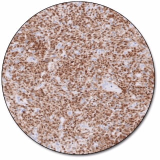 MAGE-A4 IHC 1F9 pharmDx 