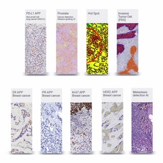 Visiopharm Translational Packages RUO