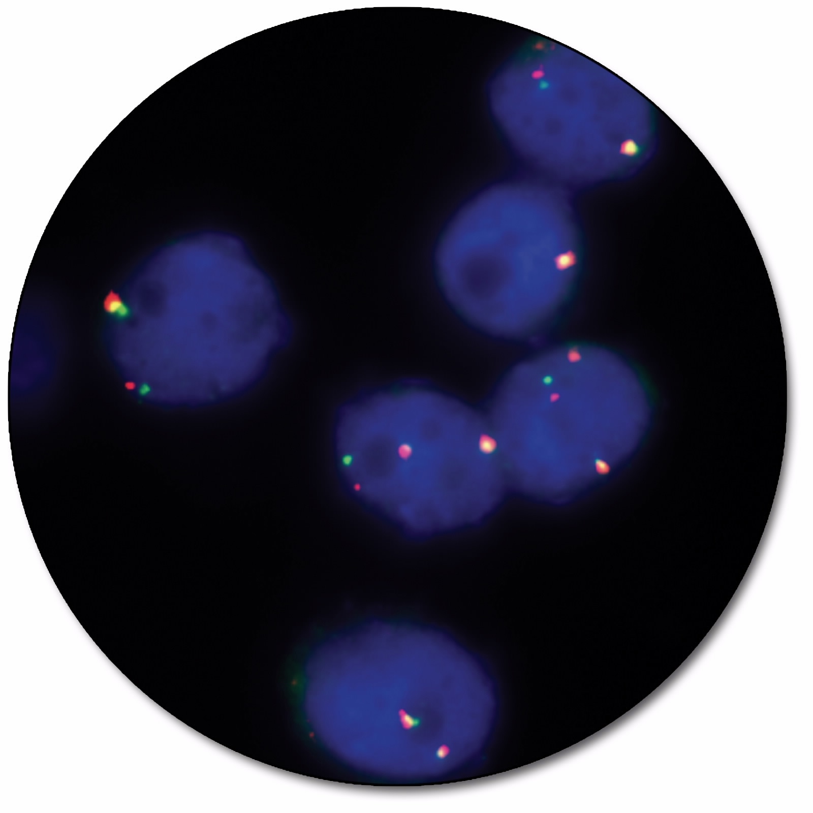 RET IQFISH Break-Apart Probe