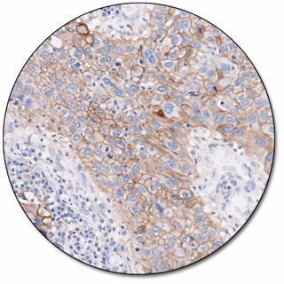 PD-L1 IHC 28-8 pharmDx for Autostainer Link 48