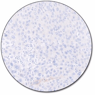 PD-L1 IHC 28-8 pharmDx for Autostainer Link 48