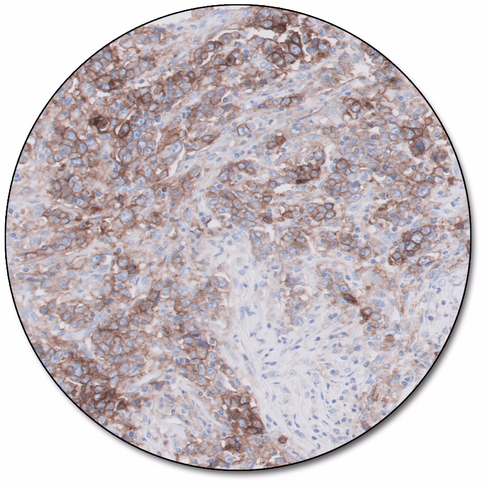 PD-L1 IHC 28-8 pharmDx for Autostainer Link 48