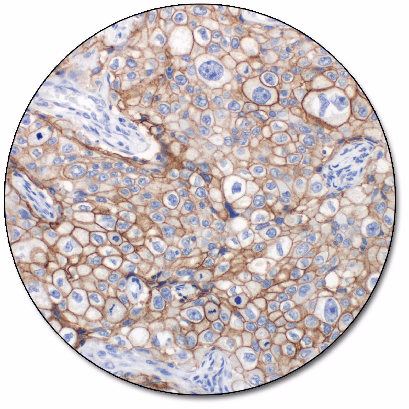PD-L1 IHC 28-8 pharmDx for Autostainer Link 48