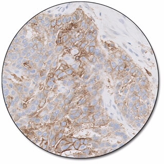 PD-L1 IHC 22C3 pharmDx for Autostainer Link 48
