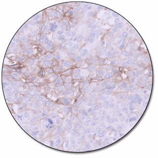PD-L1 IHC 22C3 pharmDx for Autostainer Link 48