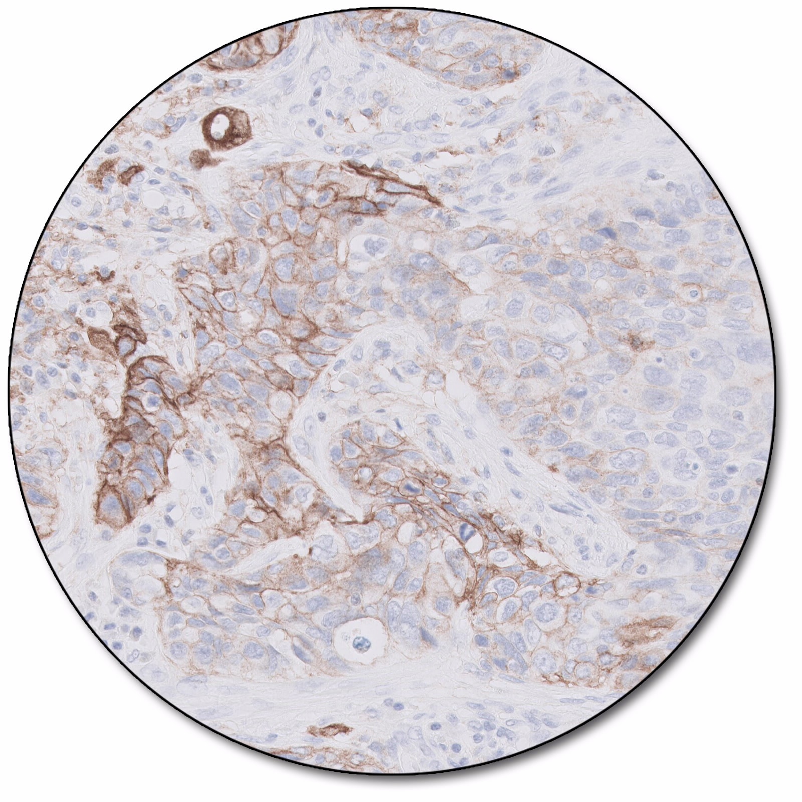 PD-L1 IHC 22C3 pharmDx「ダコ」：ダコ<br><br>Autostainer Link 48 用 PD-L1 検査キット