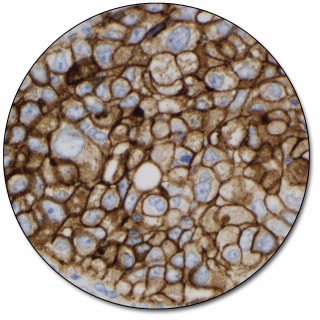 PD-L1 IHC 22C3 pharmDx for Autostainer Link 48
